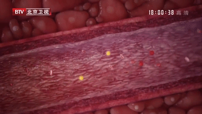 经常吃大蒜能降血压？医生：想稳定血压，这3类食物真得少吃