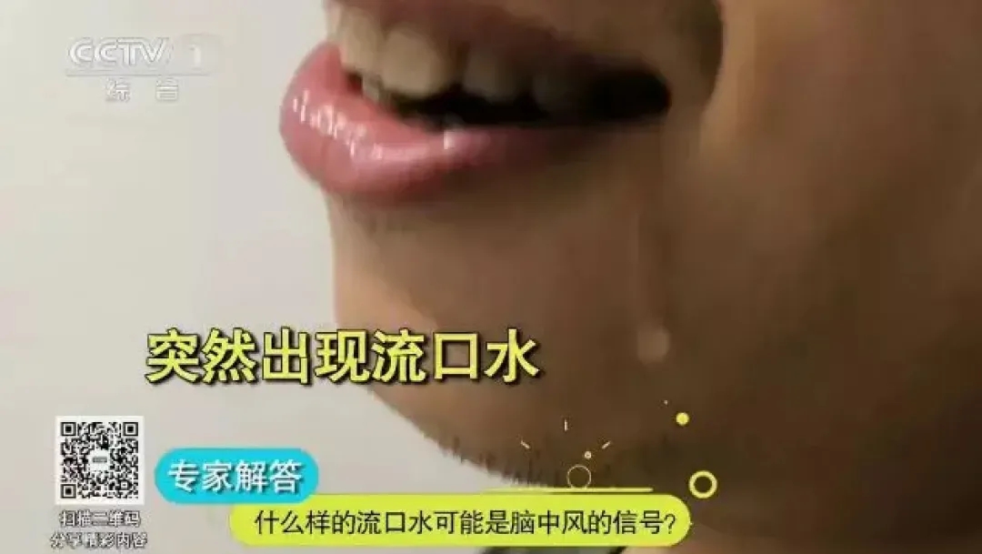 睡觉|睡觉时经常流口水可能是疾病信号？别急，分这几种情况