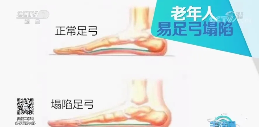 鞋子|原来鞋子选不对真的毁关节，以后少穿这4种鞋！