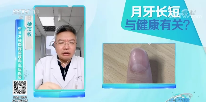 指甲|请低头：长这几种指甲的人注意了