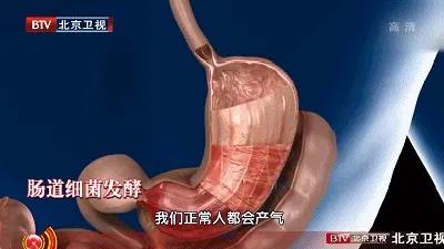 身体|肚子不饿却总是“咕咕叫”?可能是身体在报警