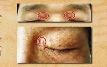 注意！这几种面相可能预示着心脏疾病，很多人都忽视了……