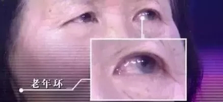 注意！这几种面相可能预示着心脏疾病，很多人都忽视了……