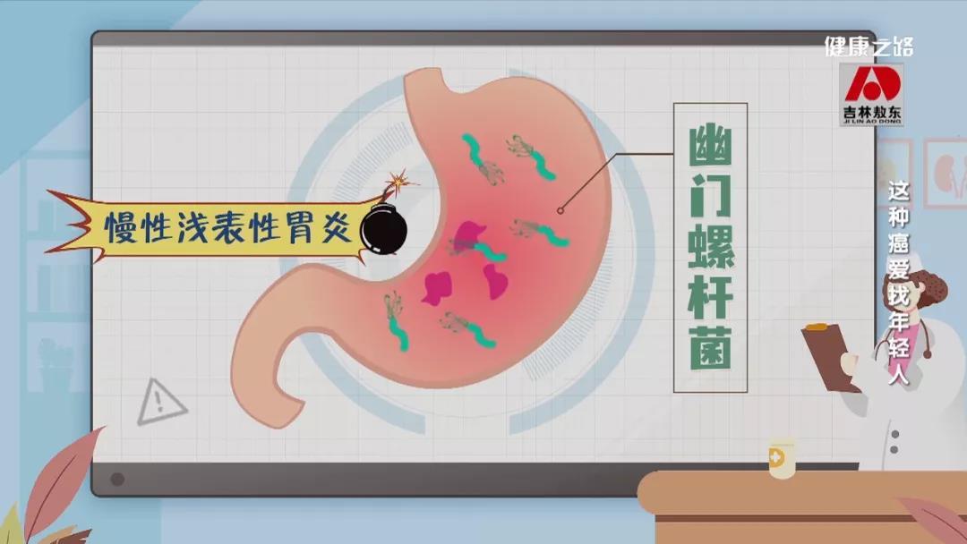 这种癌爱找年轻人！看看这些坏习惯你中招了吗？