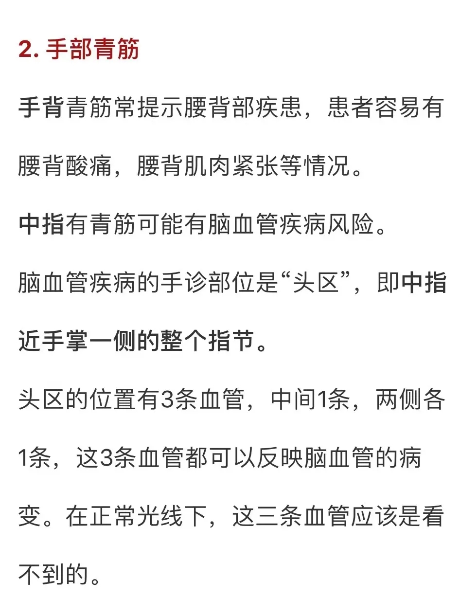 真没开玩笑！身体这些部位青筋凸起，可能对应这些病！