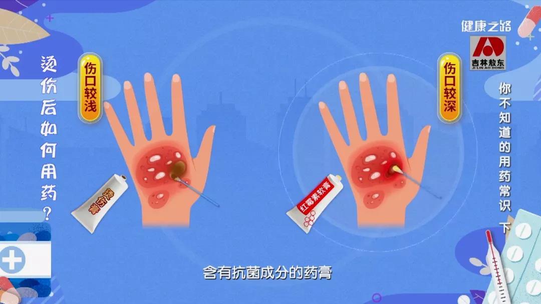 碘伏、烫伤膏、眼药水……这些经常使用的药您用对了吗？