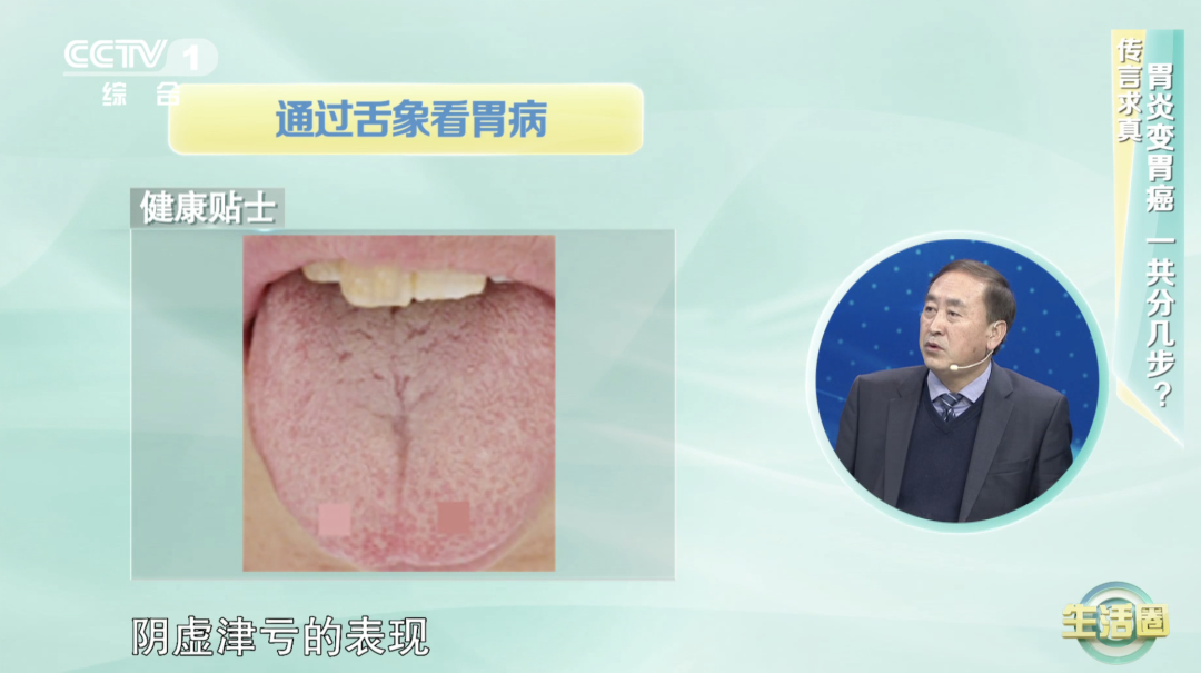 从胃炎到胃癌只需4步!控制它是早期最有力的阻断方法