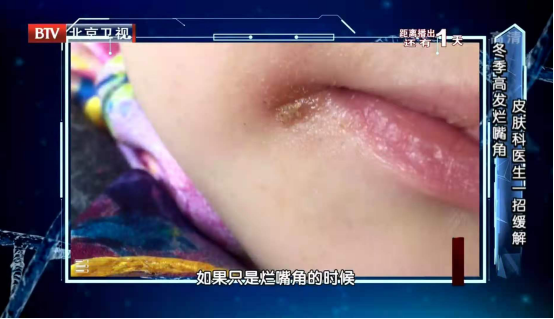 这7个习惯赶紧改，可能诱发＂致命危机＂！看完才知道有多危险…