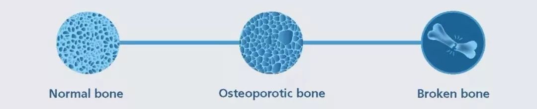 女性的膝盖更易“跑偏”,一个动作就知道它稳不稳