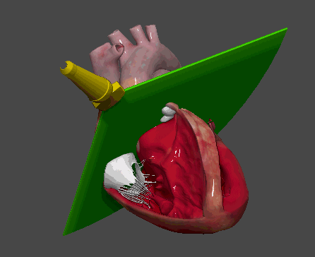 震惊!心脏竟是个莫比乌斯环?更让人意外的是…