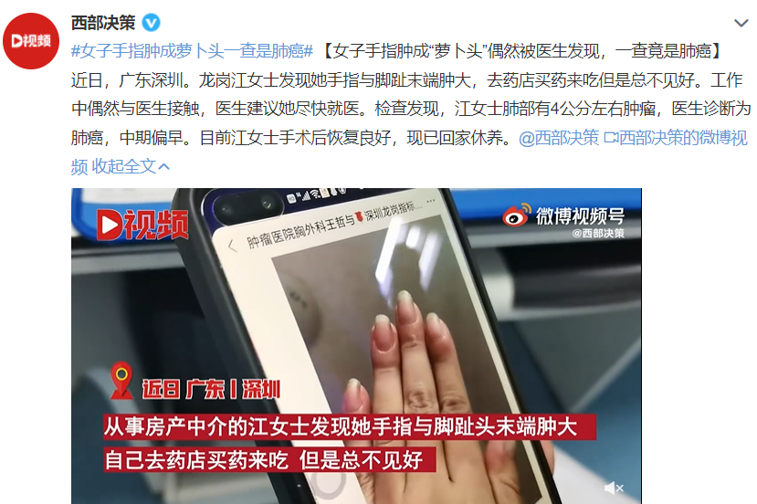 女子手指变粗,一查竟是肺癌!出现这些症状,疾病可能正悄悄靠近