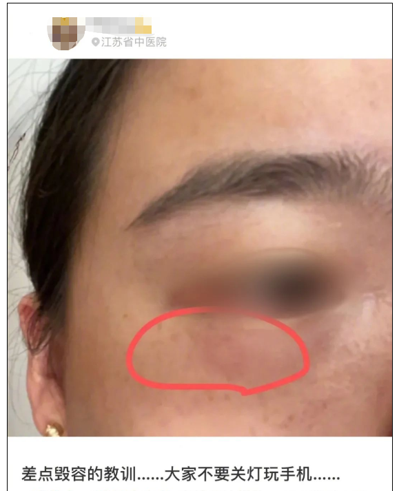 这种虫子毒液堪比硫酸,千万小心!