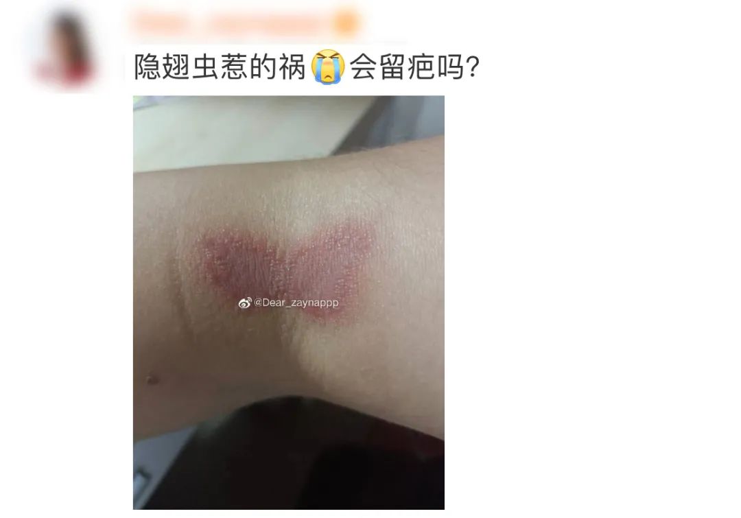 这种虫子毒液堪比硫酸,千万小心!