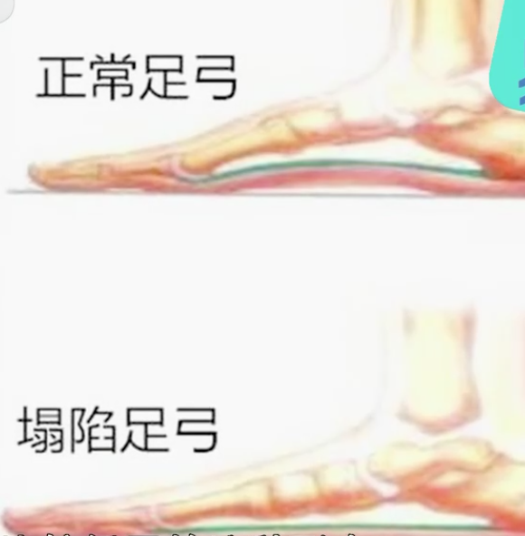 老人鞋买不好，可能变成“坑老鞋”！