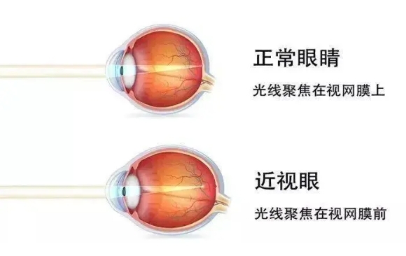 市场监管总局：严厉打击针对儿童青少年的这类违法营销行为！